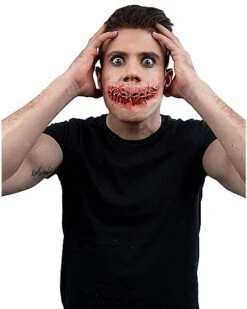 Sewn Mouth Appliance